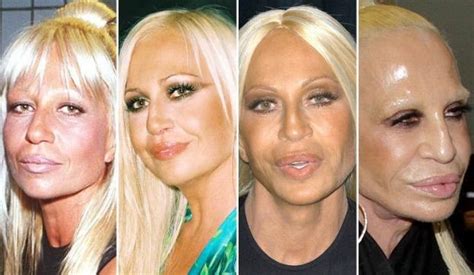 donatella versace transformation.